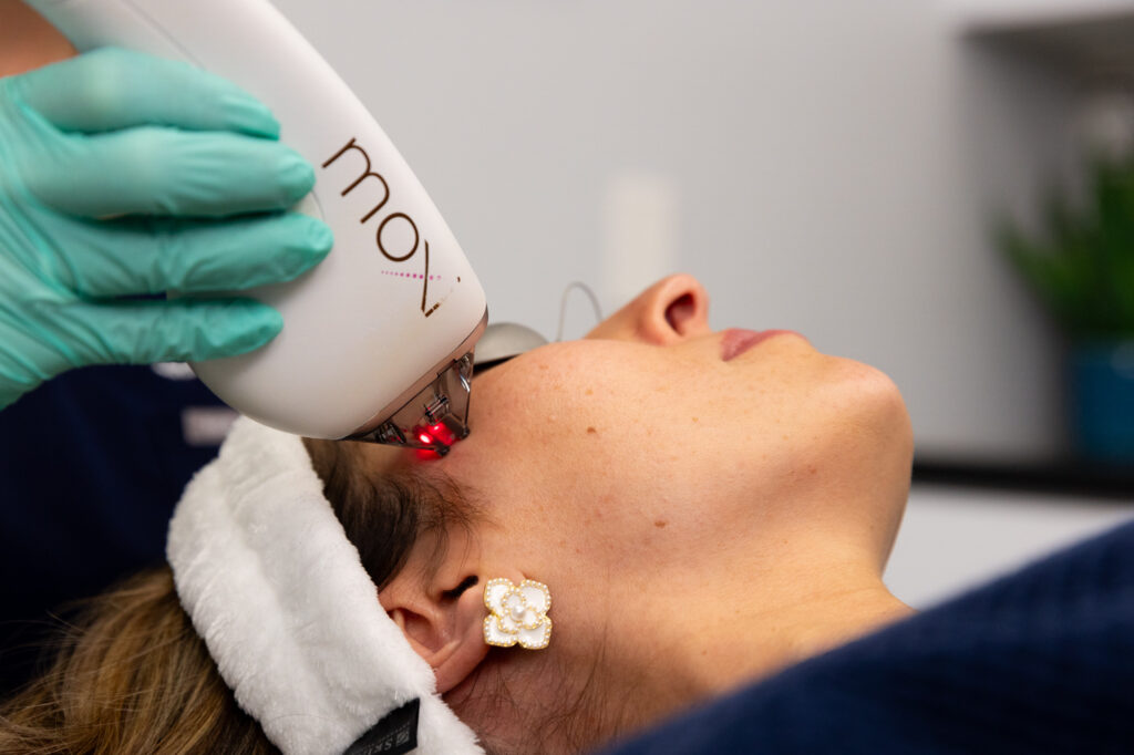 Woman using Moxi laser near Marana, AZ, for prejuvenation and to fix sun damage.